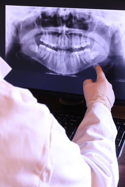 Best Emergency Treatment for Dental Infections or Abscesses in Mira Monte, CA